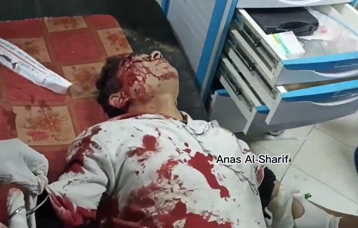 Thumbnail preview image for the video titled: Gravely wounded teen recites Quran on emergency bed