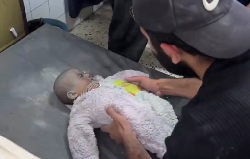 Thumbnail preview image for the video titled: Father embraces his baby girl killed in Israeli bombing of a house