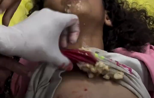 Thumbnail preview image for the video titled: Children injured by shrapnel after an Israeli airstrike on a car
