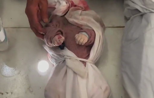 Thumbnail preview image for the video titled: Beheaded baby girl Amal among multiple children massacred in Israeli bombing of UNRWA clinic