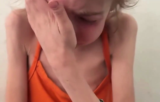 Thumbnail preview image for the video titled: 12-year-old Rahaf Ayyad from Al-Shuja'iya neighorhood in Gaza city is suffering from severe malnutrition