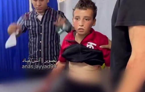 Thumbnail preview image for the video titled: Child injured in Israeli massacre of well diggers in North Gaza