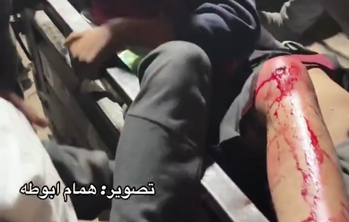 Thumbnail preview image for the video titled: Casualties from GHF site massacre arrive at the ICRC field hospital