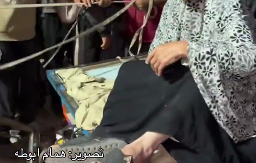 Thumbnail preview image for the video titled: Casualties from GHF site massacre arrive at the ICRC field hospital