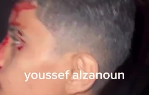 Thumbnail preview image for the video titled: Injuries after Israeli gunboats shelled the tents of displaced people on the Gaza City shore