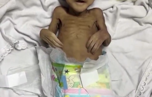 Thumbnail preview image for the video titled: 3 months old baby Ahmad Tlaib killed by Israel's starvation policy