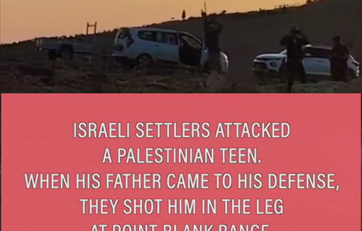 Thumbnail preview image for the video titled: Pogrom, unlawful arrest and surgery on Sa’id al-‘Amur — B’Tselem Report