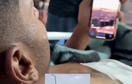 Thumbnail preview image for the video titled: Testimony of young man injured by gunfire at a Rafah GHF site