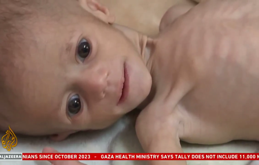 Thumbnail preview image for the video titled: For those who have not been killed by Israels relentless bombardment, a slow death by starvation is now a very real threat