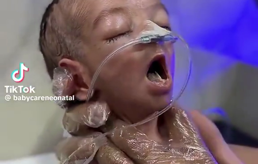 Thumbnail preview image for the video titled: This is beyond evil… infants are suffering while aid is blocked