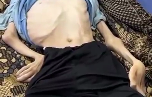 Thumbnail preview image for the video titled: Teen Karam Khaled Al-Jamal killed by Israel's food and medication blockade