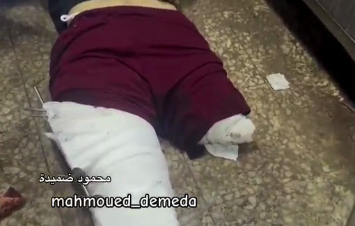 Thumbnail preview image for the video titled: Father killed while seeking aid despite having already lost one leg