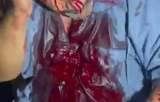 Thumbnail preview image for the video titled: Israeli settlers attacked and injured a couple in their home a home in Masafer Yatta