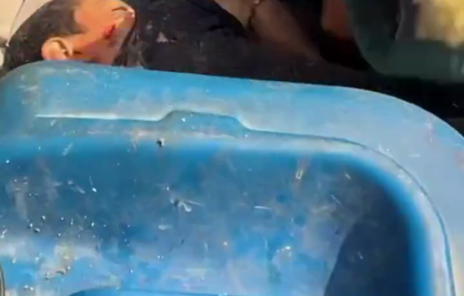 Thumbnail preview image for the video titled: Child's arm gruesomely mangled in Israeli bombing of Amr ibn al-Aas school