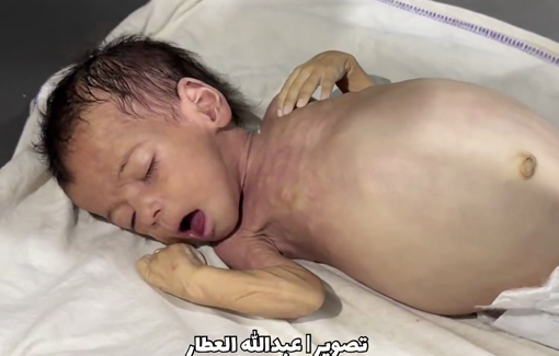 Thumbnail preview image for the video titled: Baby Raseel Abu Masoud killed by Israel's starvation policy