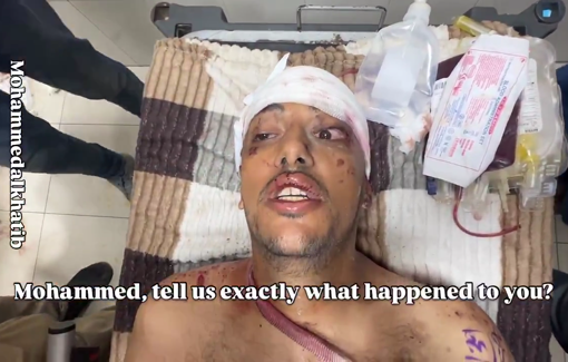 Thumbnail preview image for the video titled: Testimony of wounded journalist Mohammed Fayq about the Nasser hospital double-tap