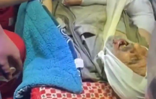 Thumbnail preview image for the video titled: During the night, 25 Israeli settlers seriously injured 13 Palestinians in Khalet al Dabaa