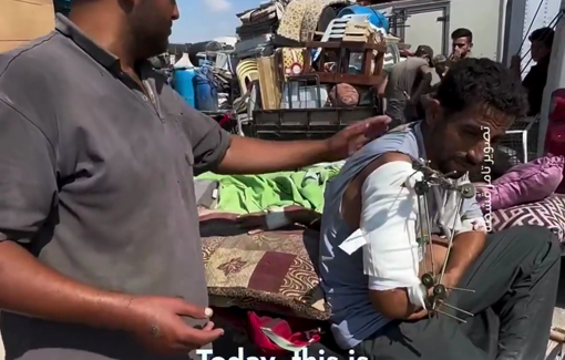Thumbnail preview image for the video titled: Men with broken limbs from Israeli shelling forcibly displaced on carts without proper medical care