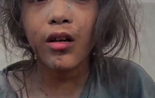 Thumbnail preview image for the video titled: Little girl trembles after being injured in an Israeli airstrike