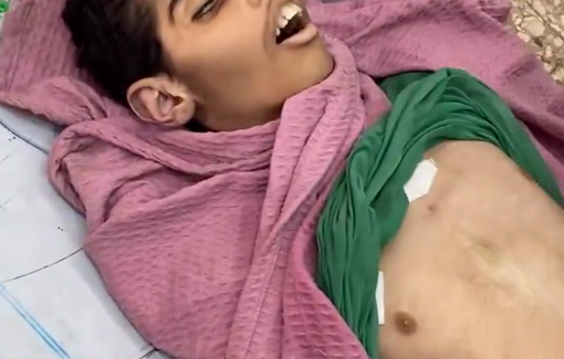 Thumbnail preview image for the video titled: Child Ahmad Al-Sharif dies from malnutrition due to Israel's blockade