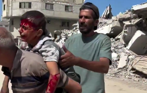 Thumbnail preview image for the video titled: Children injured in Israel bombing of houses in the Abu Hasira area western Gaza City