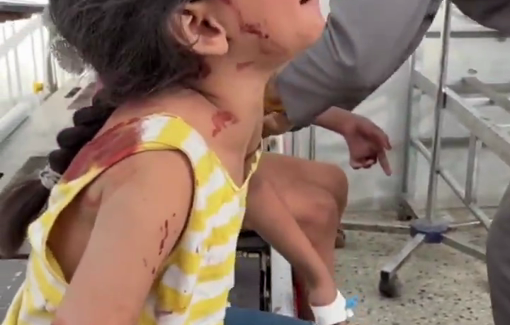 Thumbnail preview image for the video titled: Injured child's wish: “Oh Lord, let me die and find peace"