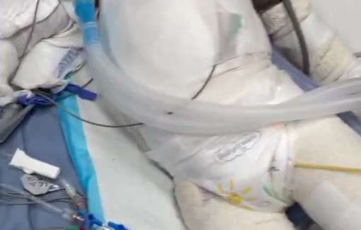 Thumbnail preview image for the video titled: Wounded baby with serious burn injuries, sole survivor of his family