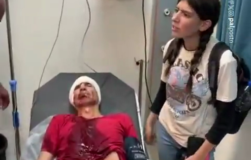 Thumbnail preview image for the video titled: A solidarity activist seriously injured in a settler attack on Mount Qamas (Beita)