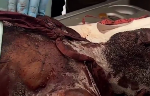 Thumbnail preview image for the video titled: Israel returns the bodies of Palestinians it tortured to death without any identification