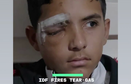 Thumbnail preview image for the video titled: Israeli soldier fired tear-gas canister in the face of a schoolboy waiting for his school bus