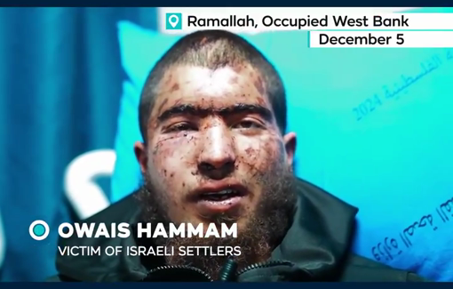Thumbnail preview image for the video titled: Owais Hammam abducted, beaten and interrogated for hours by illegal Israeli settlers before being thrown onto a roadside