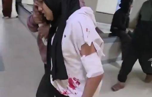 Thumbnail preview image for the video titled: A palestinian girl injured by Israeli gunfire in Khan Younis City