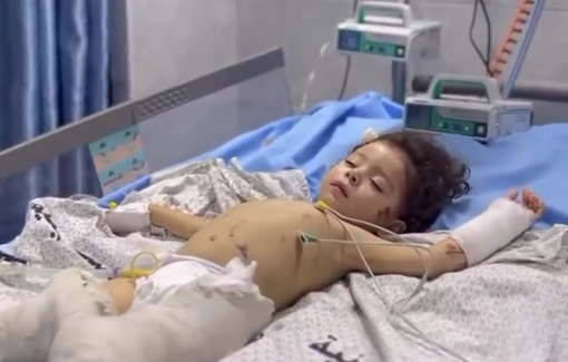 Thumbnail preview image for the video titled: A little girl lost all her family members, except her father, in an Israeli air strike