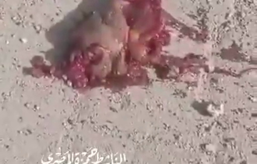 Thumbnail preview image for the video titled: Heart beats after being blasted out of a Palestinian's body by Israeli bombing